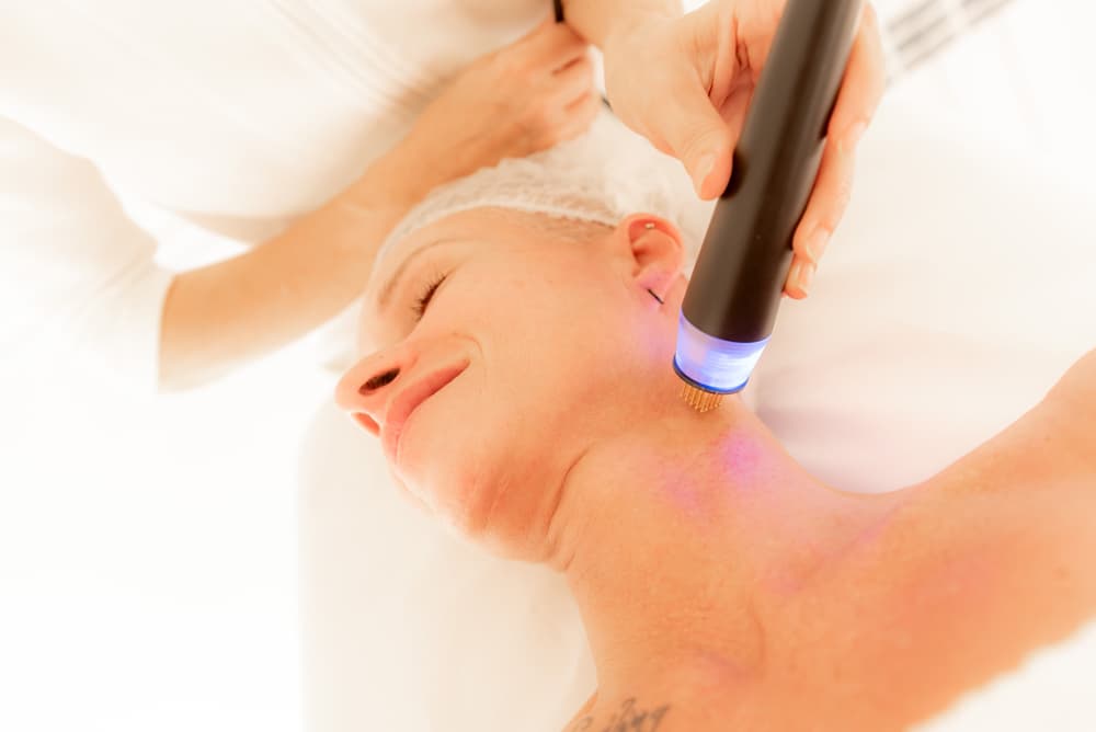 Inductores de colágeno