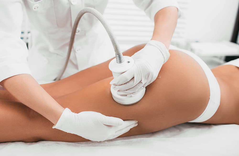 Mesoterapia para reducción de grasa y celulitis localizada