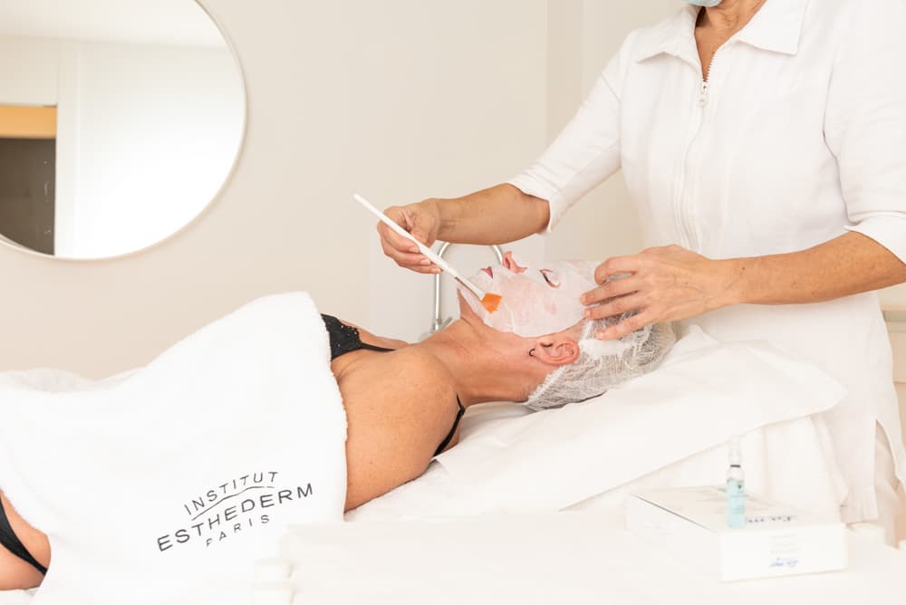 eliminar marcas de acne en Vigo